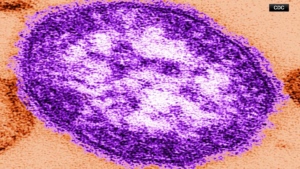 Measles Outbreak in Pennsylvania Highlights Vaccine Skepticism and Public Health Trust